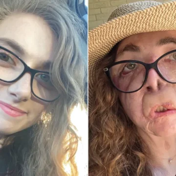 Jacqueline Durand Case: Texas Dog-Sitting Incident and Her Journey to Recovery