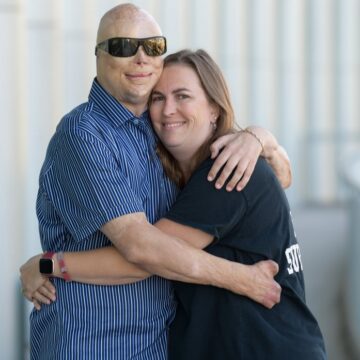 Joe Kinan Story: Station Nightclub Fire Survivor and Groundbreaking Hand Transplant