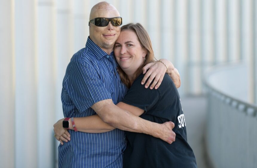 Joe Kinan Story: Station Nightclub Fire Survivor and Groundbreaking Hand Transplant