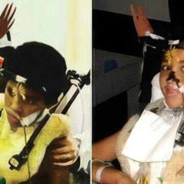 Jordan Taylor Survival Story: Rare Spinal Injury and Remarkable Recovery